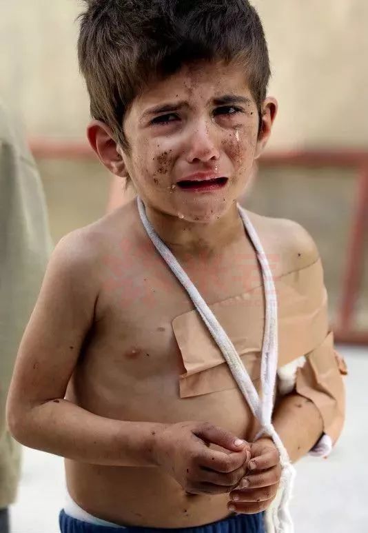 催泪的20张照片看战争之下的叙利亚